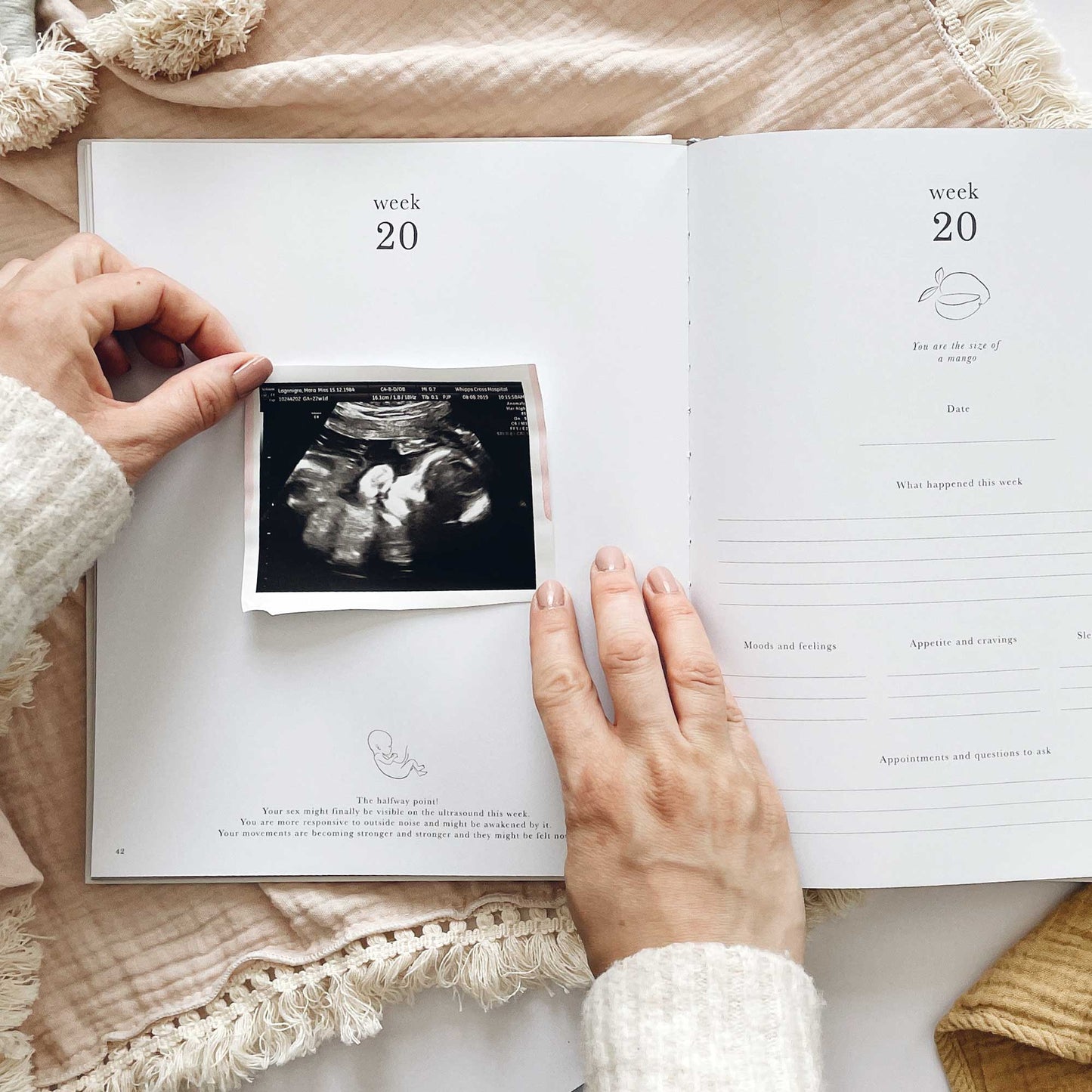 Safari Pregnancy Keepsake Journal with Gilded Edges